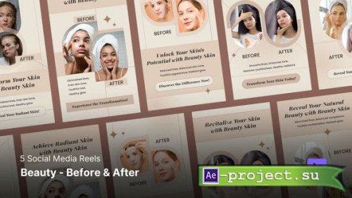 Videohive - Social Media Reels - Beauty Before and After - 45981770 - Project for After Effects