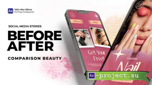 Videohive - Before After Comparison Beauty - Social Media Stories - 51464922 - Project for After Effects