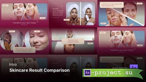 Videohive - Intro/Opening - Skincare Result Comparison After Effects Project Files - 54167532 - Project for After Effects