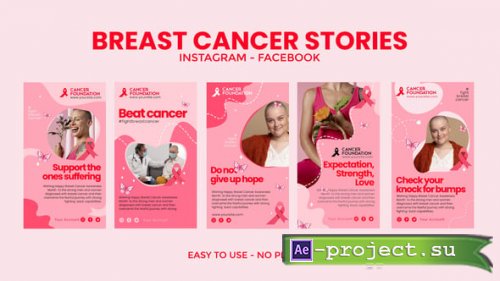 Videohive - Breast Cancer Instagram Stories - 55416860 - Project for After Effects