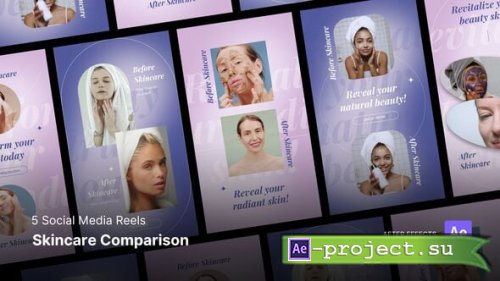 Videohive - Social Media Reels - Skincare Result Comparison After Effects Project Files - 55392517 - Project for After Effects