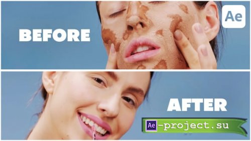 Videohive - Clean Before and After - 59281438 - Project for After Effects