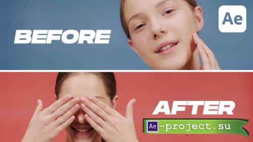 Videohive - Dynamic Before & After - 59502875 - Project for After Effects