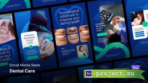 Videohive - Reels - Dental Care After Effects Project Files - 59823502 - Project for After Effects