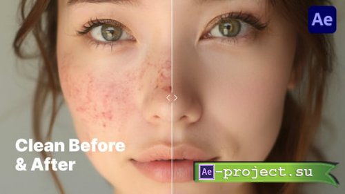 Videohive - Minimalistic & Clean Before & After Comparison  Premiere Pro Template - 60207350 - Project for After Effects