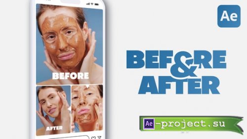 Videohive - Vertical Clean Before and After - 60826615 - Project for After Effects