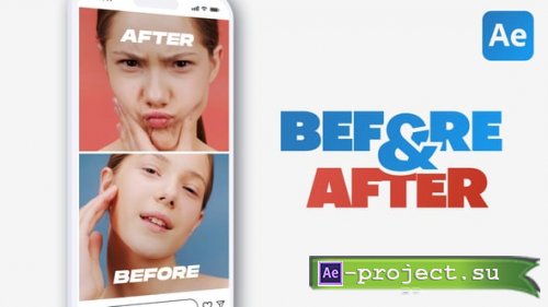 Videohive - Vertical Dynamic Split Screens - 61391064 - Project for After Effects